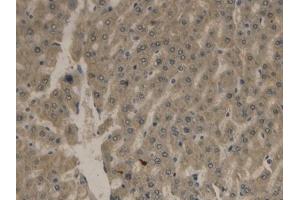 Detection of APOB in Rat Liver Tissue using Polyclonal Antibody to Apolipoprotein B (APOB)