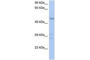 anti-PXYLP1 / ACPL2 (AA 143-192) antibody