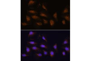 Immunofluorescence analysis of U-2 OS cells using RPS6K antibody (5718) at dilution of 1:100. (RPS6KA1 anticorps  (C-Term))
