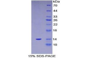 SDS-PAGE (SDS) image for S100 Calcium Binding Protein A11 (S100A11) (AA 1-105) protein (His tag) (ABIN1080695) (S100A11 Protein (AA 1-105) (His tag))