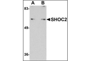 Western blot analysis of SHOC2 in Jurkat cell lysate with this product at (A) 1 and (B) 2 μg/ml. (SHoc2/Sur8 anticorps  (N-Term))