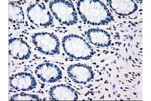 Image no. 2 for anti-Polo-Like Kinase 1 (PLK1) antibody (ABIN1500281)