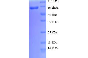 SDS-PAGE (SDS) image for Cadherin 12 (AA 56-605), (partial) protein (His tag) (ABIN5712842)