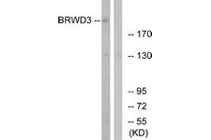 Western blot analysis of extracts from COLO cells, using BRWD3 Antibody. (BRWD3 anticorps  (AA 1751-1800))