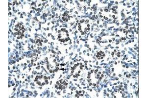 Image no. 1 for anti-Homeobox B9 (HOXB9) (AA 67-116) antibody (ABIN6735813)