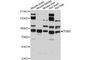 Western blot analysis of extracts of various cell lines, using ITGB5 antibody (ABIN5971332) at 1/500 dilution. (Integrin beta 5 anticorps)