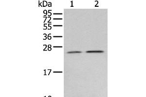 Western blot analysis of Human fetal brain tissue 231 cell using RAB11A Polyclonal Antibody at dilution of 1:400 (RAB11A anticorps)