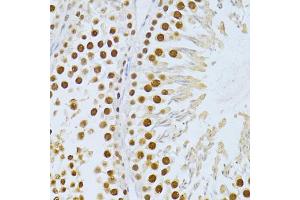 Immunohistochemistry of paraffin-embedded rat testis using SIRT1 antibody (ABIN5998812) at dilution of 1/100 (40x lens). (SIRT1 anticorps)
