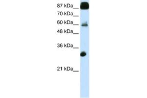 Western Blotting (WB) image for anti-CCCTC-Binding Factor (Zinc Finger Protein) (CTCF) antibody (ABIN2461796) (CTCF anticorps)