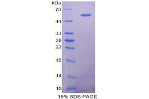 SDS-PAGE (SDS) image for 5'-Nucleotidase, Ecto (CD73) (NT5E) protein (ABIN1078683) (CD73 Protéine)