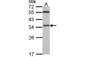 WB Image VDAC2 antibody [C2C3], C-term detects VDAC2 protein by western blot analysis.