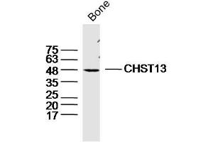 Mouse bone lysates probed with CHST13 Polyclonal Antibody, Unconjugated  at 1:300 dilution and 4˚C overnight incubation. (CHST13 anticorps  (AA 151-250))
