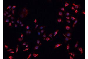 anti-Oxidized Low Density Lipoprotein (Lectin-Like) Receptor 1 (OLR1) (N-Term) antibody