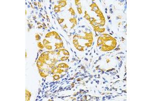 Immunohistochemistry of paraffin-embedded human stomach using MMP2 antibody.