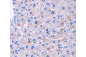 Used in DAB staining on fromalin fixed paraffin- embedded liver tissue