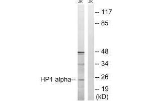 Western blot analysis of extracts from Jurkat cells, treated with insulin (0. (CBX5 anticorps  (Ser92))