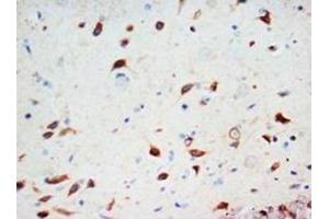 Immunohistochemical analysis of paraffin-embedded rat tissue sections (brain), staining SCDG3 in cytoplasm, DAB chromogenic reaction