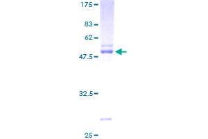 Image no. 1 for Ephrin A3 (EFNA3) (AA 1-238) protein (GST tag) (ABIN1352401)