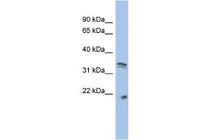WB Suggested Anti-CDC2  Antibody Titration: 0. (CDK1 anticorps  (Middle Region))