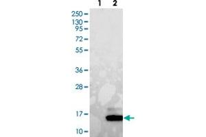 Western blot analysis of Lane 1: Negative control (vector only transfected HEK293T lysate). (GUCA2A anticorps)