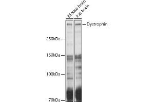 Western blot analysis of extracts of various cell lines, using Dystrophin antibody (ABIN1679546, ABIN3015473, ABIN3015474 and ABIN6218357) at 1:1000 dilution.