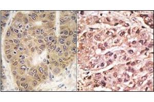 Image no. 1 for anti-Small Ubiquitin Related Modifier 4 (SUMO4) (M55V) antibody (ABIN356787)