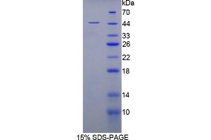 SDS-PAGE analysis of Rabbit MSE Protein. (MSE Protéine)