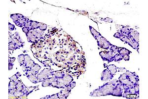 Formalin-fixed and paraffin embedded rat pancreas labeled with Anti NOX2/gp91phox Polyclonal Antibody, Unconjugated (ABIN750688) at 1:200 followed by conjugation to the secondary antibody and DAB staining (CYBB anticorps  (AA 501-570))