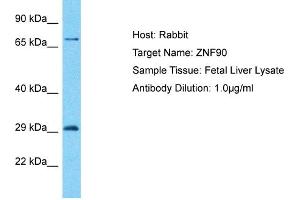 Host: Rabbit Target Name: ZNF90 Sample Type: Fetal Liver lysates Antibody Dilution: 1. (ZNF90 anticorps  (C-Term))