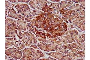 anti-ELMO/CED-12 Domain Containing 3 (ELMOD3) (AA 1-102) antibody