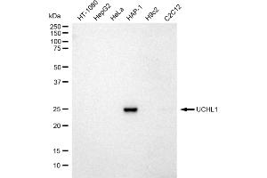 Western blotting analysis using UCHL1 antibody (ABIN7800708).