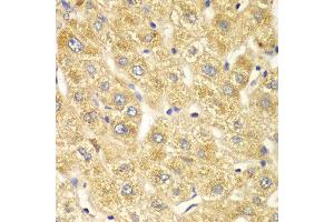 Immunohistochemistry of paraffin-embedded human liver injury using OGT antibody at dilution of 1:100 (x40 lens). (OGT anticorps)