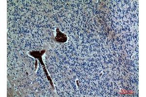Immunohistochemistry (IHC) analysis of paraffin-embedded Human Brain, antibody was diluted at 1:100.