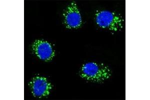 Confocal immunofluorescent analysis of MUSK antibody with MDA-MB231 cells followed by Alexa Fluor 488-conjugated goat anti-rabbit lgG (green).