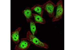 Immunofluorescence analysis of ECA109 cells using KLF4 mouse mAb (green). (KLF4 anticorps)