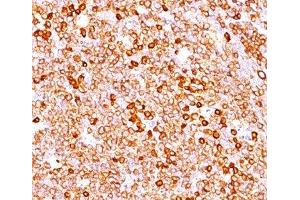 IHC testing of human tonsil (20X) stained with CD79a antibody cocktail (JCB117 + HM47/A9). (CD79a anticorps  (AA 202-216))