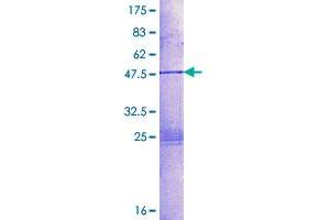 Image no. 1 for Heart and Neural Crest Derivatives Expressed 2 (HAND2) (AA 1-180) protein (GST tag) (ABIN1306341)