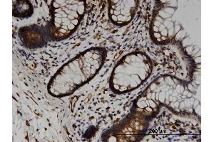 Immunoperoxidase of monoclonal antibody to TRAM2 on formalin-fixed paraffin-embedded human colon. (TRAM2 anticorps  (AA 310-369))