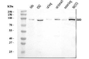Western blot analysis of Smoothened/SMO using anti-Smoothened/SMO antibody (ABIN7601825).