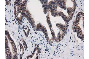 Image no. 4 for anti-Catenin (Cadherin-Associated Protein), beta 1, 88kDa (CTNNB1) antibody (ABIN1496890) (CTNNB1 anticorps)