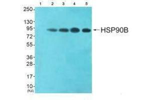 Western blot analysis of extracts from HeLa cells (Lane 2), CoLo cells (Lane 3), HepG2 cells (Lane 4) and 293 cells (Lane 5), using HSP90B (Ab-254) antiobdy. (HSP9AB1 (Ser254) anticorps)