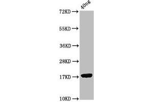anti-Porcine Reproductive and Respiratory Syndrome Virus ORF7 (AA 1-123) antibody