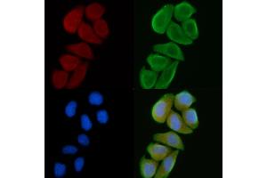 ABIN6260466 and ABIN6272266 staining Hela cells(30 min of UV treatment) by IF/ICC. (CSNK1G1 anticorps  (C-Term))