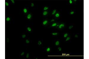 Immunofluorescence of monoclonal antibody to GTF2I on HeLa cell. (GTF2I anticorps  (AA 36-274))
