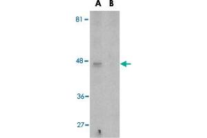 Western blot analysis of APOBEC3G expression in Caco-2 cell lysate in the (A), absence and (B) presence of blocking peptide with APOBEC3G polyclonal antibody  at 5 ug/mL .