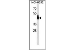 Western blot analysis of PABPC4L Antibody (C-term) in NCI-H292 cell line lysates (35ug/lane). (PABPC4L anticorps  (C-Term))