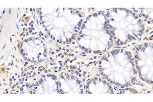 Detection of MPO in Human Colon Tissue using Monoclonal Antibody to Myeloperoxidase (MPO)