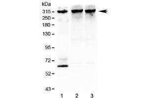 Western blot testing of 1) human SHG-44 (glioma), 2) rat brain and 3) mouse brain lysate with IP3R antibody at 1ug/ml.