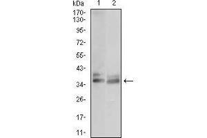 Western blot analysis using ACP5 mouse mAb against JURKAT (1) and OCM-1 (2) cell lysate.