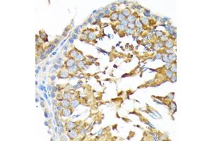 Immunohistochemistry of paraffin-embedded rat testis using  Rabbit mAb (ABIN7265532) at dilution of 1:100 (40x lens).